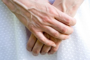 upper limb damage with varicose veins in women