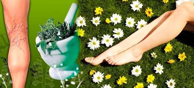 Folk remedies for varicose veins in the legs, helps a quick recovery