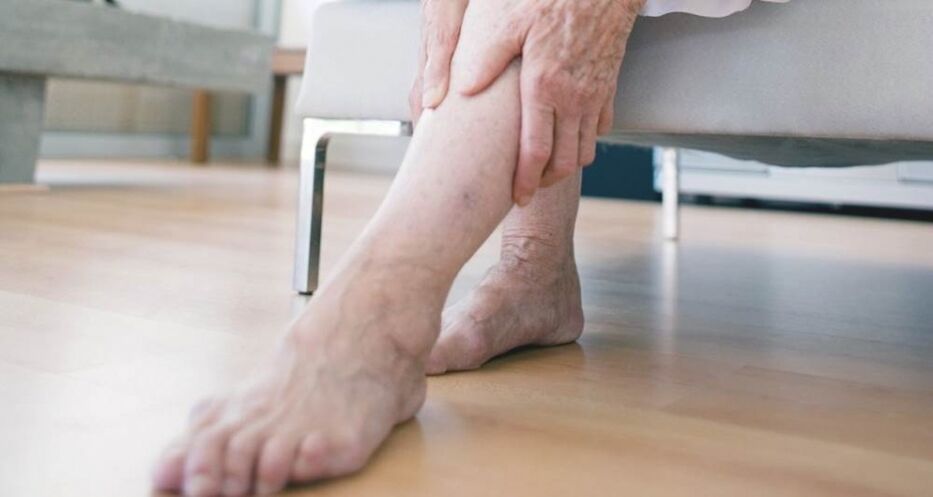 Varicose veins of the lower extremities are caused by a malfunction of the venous valve